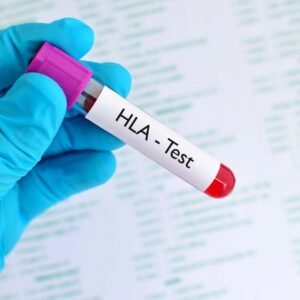 HLA چیست و چرا در پیوند کلیه حیاتی است؟